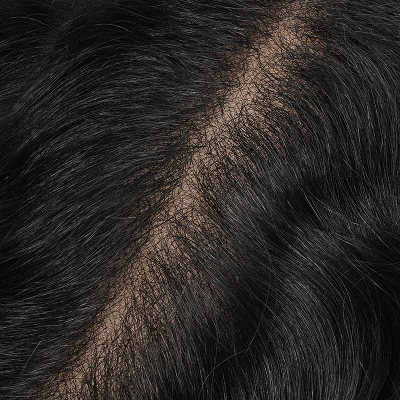 Icon Hair Patch Korean