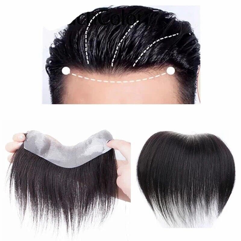 Front hairline patch for natural looking hairline and non-surgical hair fixing