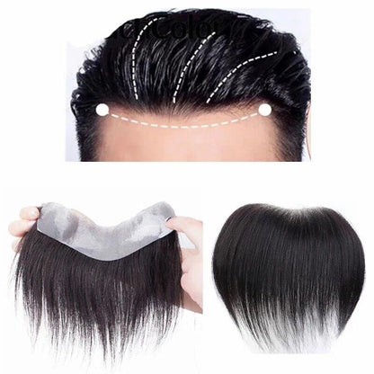 Front hairline patch for natural looking hairline and non-surgical hair fixing