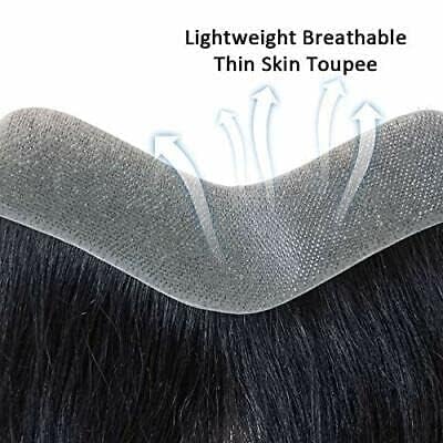 Front hairline patch for natural looking hairline and non-surgical hair fixing